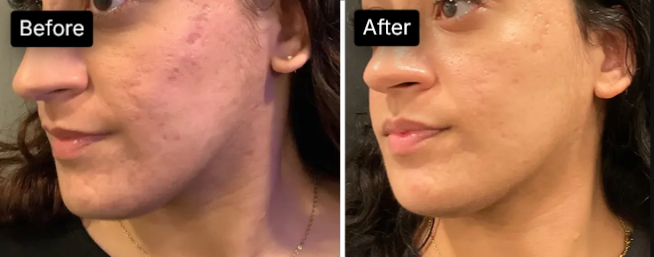 before after 5